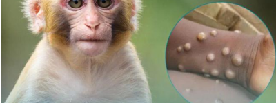 新增23例|破200例，目前台湾累计确诊猴痘病例创单周新高