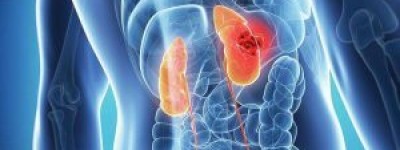 (英利达)阿昔替尼2025价格多少钱一盒医保挂网价，官宣阿昔替尼多少钱一盒