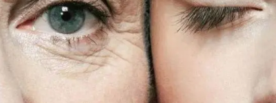 怎样去除皱纹，记住这3点能减少皱纹的产生